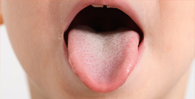 Epilepsy Survey results. We asked our readers, have you ever bitten your tongue during a seizure. Scroll down to see the responses.