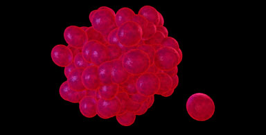 Tumor and Epilepsy Consortium: Featured Northeast Regional Epilepsy Program