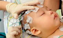 Book release: What you need to know if epilepsy has touched your life: A Guide in Plain English